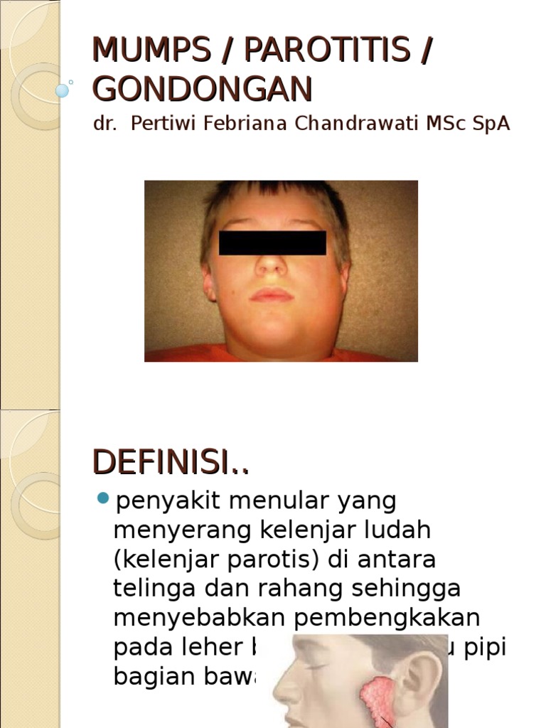 Parotitis: Gejala dan Penanganan Mumps | PDF