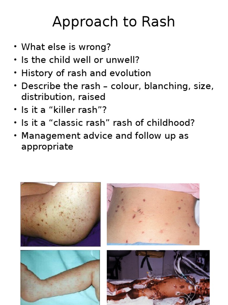 Common Rashes | PDF | Animal Diseases | Health Sciences