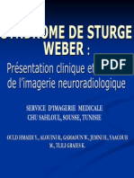 Syndrome de Sturge Weber