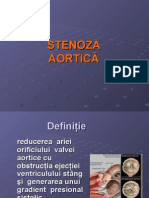 stenoza+insuficienta aortica
