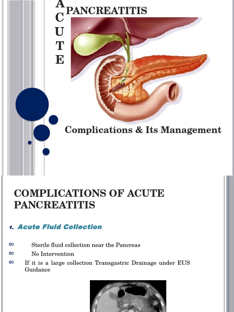 Managing Acute Pancreatitis Complications | PDF | Medical Specialties ...