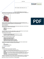 Atrial Flutter