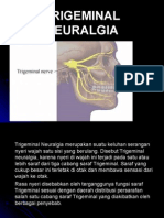 Neuralgia Trigeminus