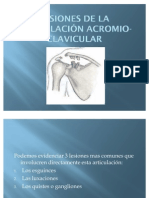 Lesion Acromio Clavicular