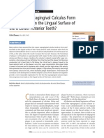 Why Does Supragingiva Calculus at Lingual Surface Anterior Teeth