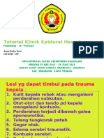 Sanni Epidural Hematom