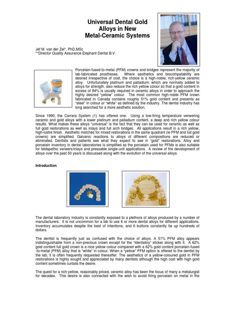 Universal Dental Gold Alloys PDF Thermal Expansion Alloy