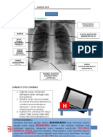 Thorax