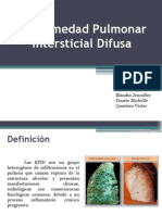 Enfermedad Pulmonar Intersticial Difusa: Causas, Diagnóstico y Tratamiento