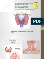 HIPERTIROIDISMO