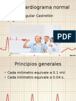 Electrocardiograma Normal