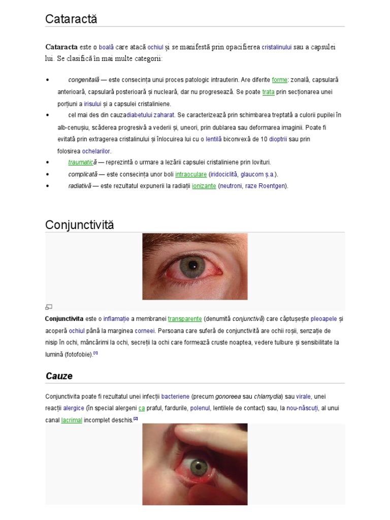 diagnostice de boli oculare tratament chirurgical pentru miopie