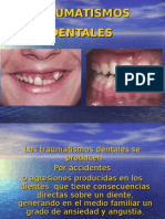 Traumatismos Dentales