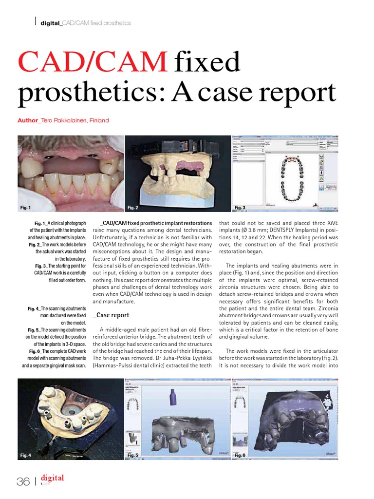 CAD/CAM Workflow for Fixed Prosthetics | PDF | Dental Implant | Dentistry