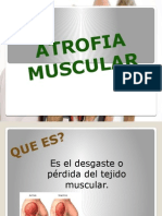 Atrofia Muscular