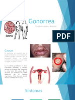 Gonorrea: Causas, síntomas y tratamiento de la infección