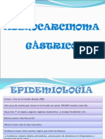 Adenocarcinoma Gástrico