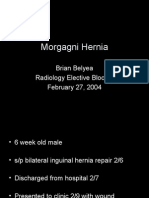 Morgagni Hernia: Brian Belyea Radiology Elective Block 8 February 27, 2004
