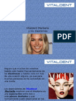 Vitaldent Marbella y los diastemas