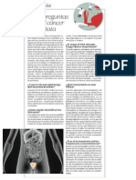 Cinco Preguntas y Respuestas sobre el Cáncer de Próstata