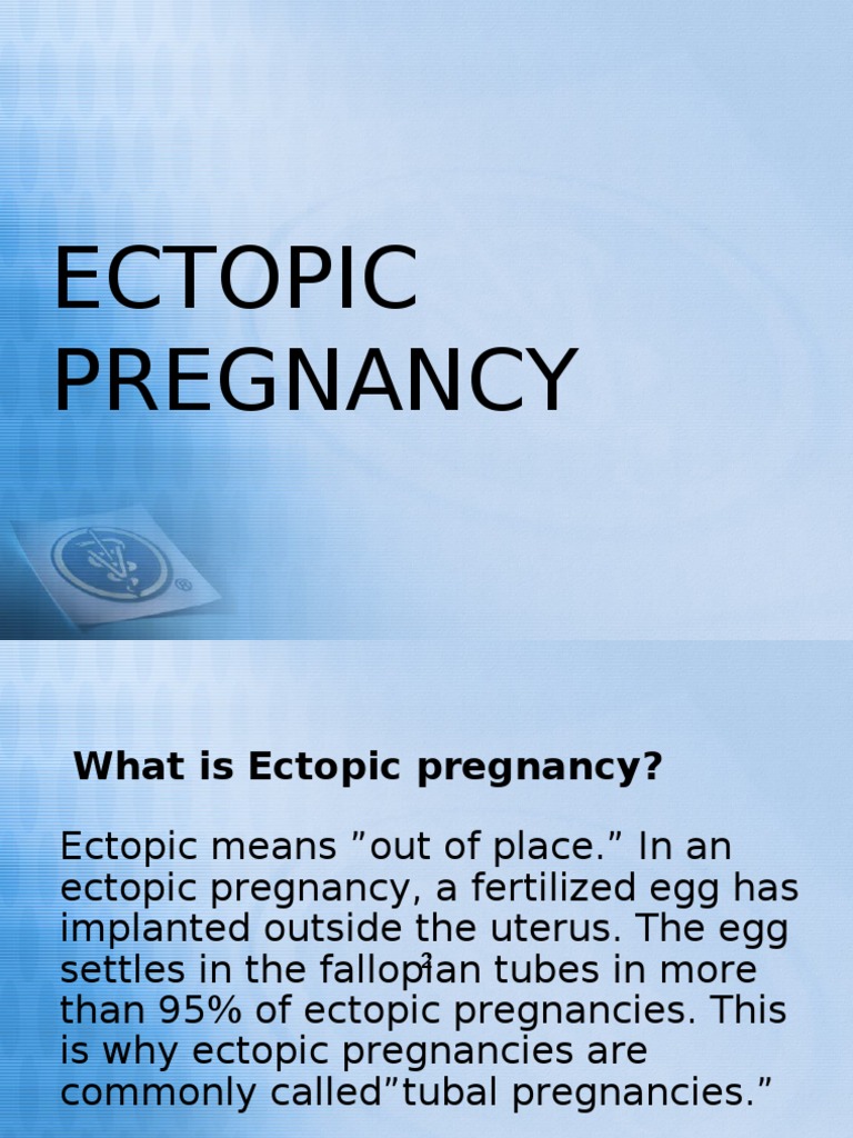 ectopic pregnancy case study scribd