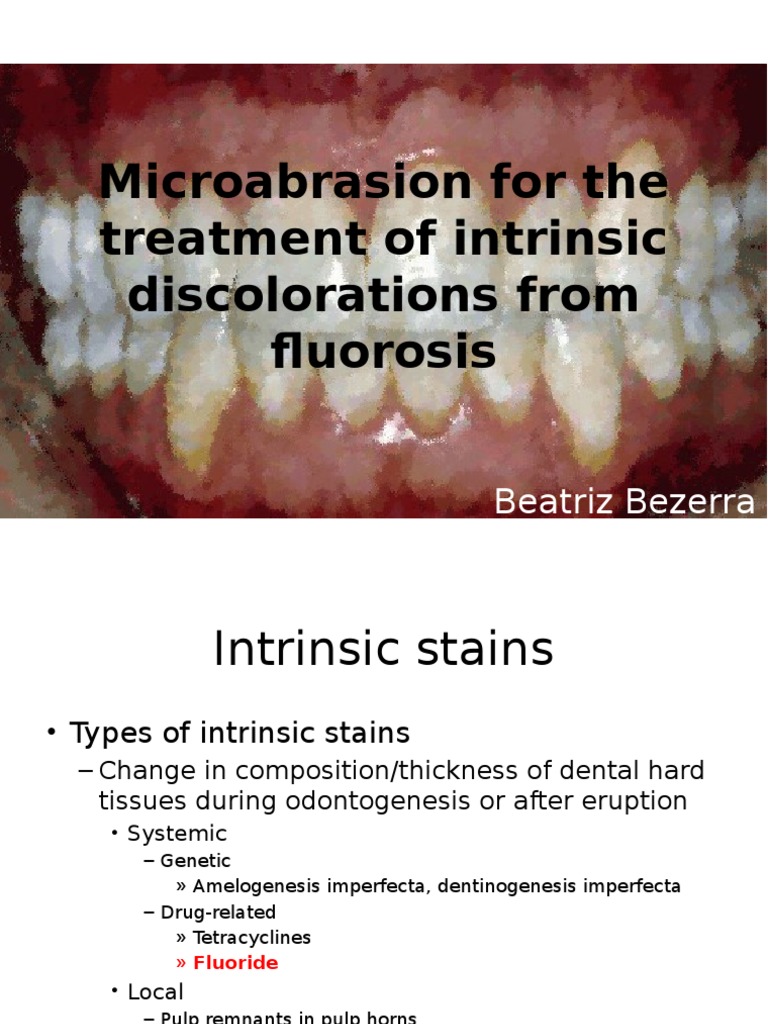 Microabrasion technique Tooth Enamel Dentistry