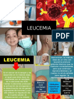 DIAPOS LEUCEMIA.pptx