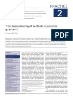 Treatment Planning of Implants in Posterior PDF