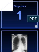 Chest X-Ray