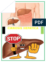 Monografia Cirrosis Hepatica