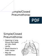Simple Pneumothorax