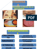 AVITAMINOSIS