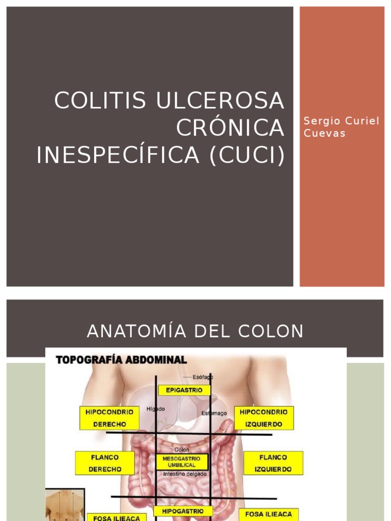 Colitis Ulcerosa: Tipos y Diagnóstico | PDF | Cáncer colonrectal ...