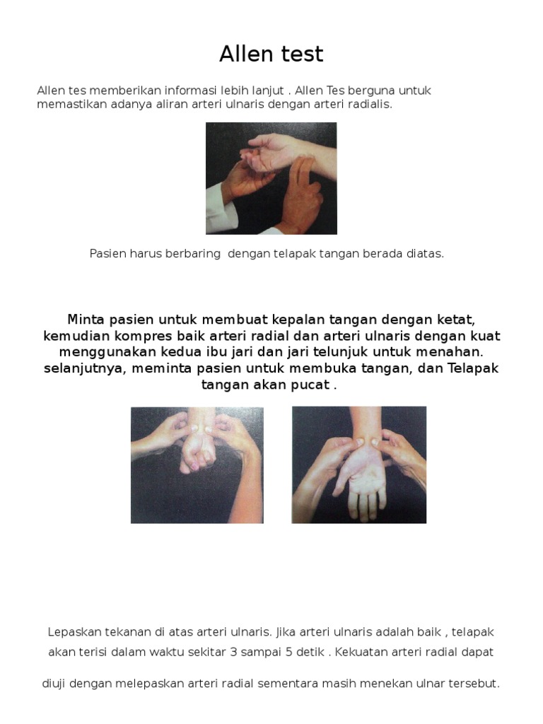 Allen Test | PDF | Kesehatan Holistik | Sains & Matematika