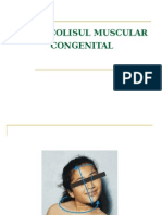Torticolisul Muscular Congenital