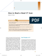 how to read head ct