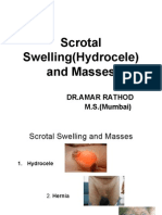 Scrotal Swelling (Hydrocele) and Masses