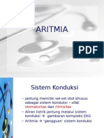 Aritmia