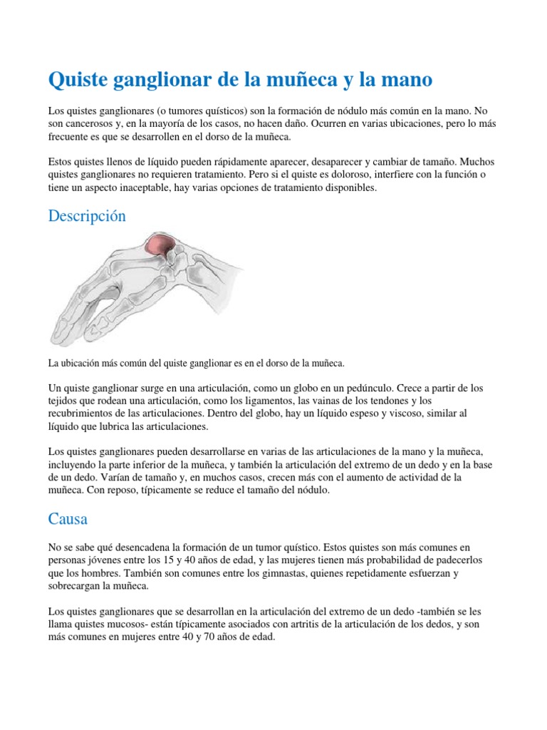 Quiste ganglionar de la muñeca y la mano | Imagen de resonancia ...