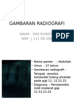 Gambaran Radiografi