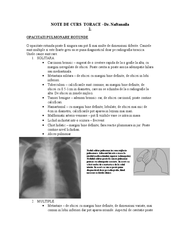 creșterea tratamentului articulației sternoclaviculare