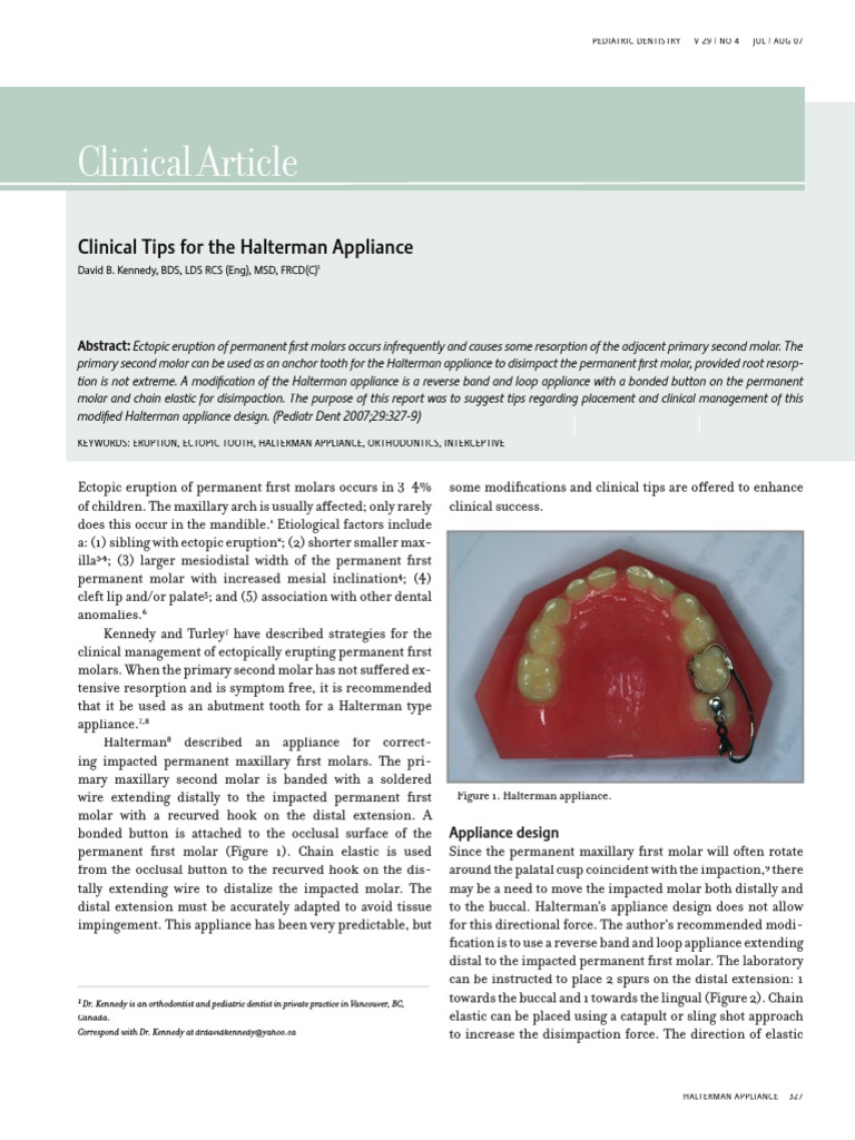 Clinical Tips For Halterman Appliance PDF Dentistry Mouth