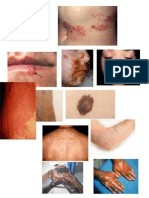 imagenes lesiones dermatologicas