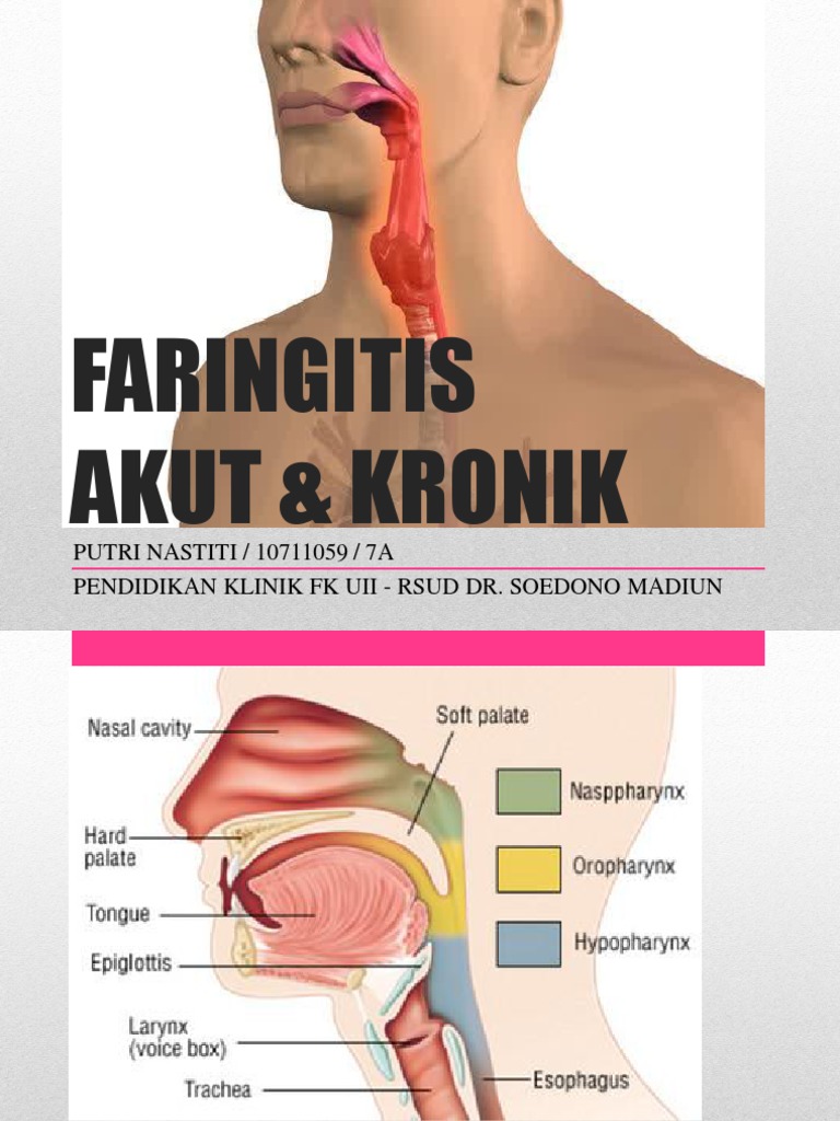 Faringitis Akut dan Kronik: Penjelasan Lengkap | PDF | Sains & Matematika