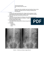 organ intraperitoneal