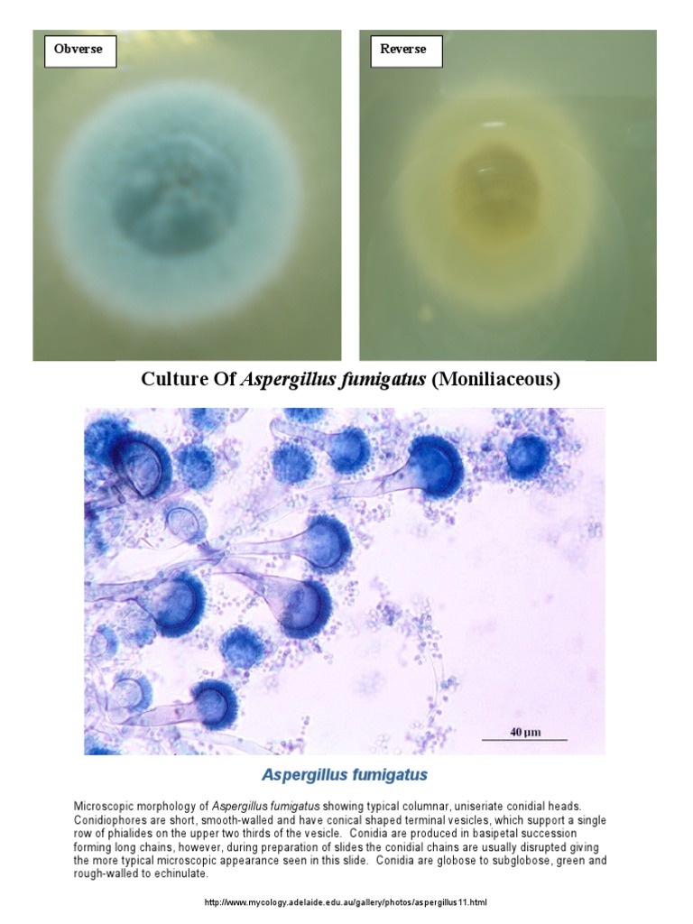 Microscopic Features of Aspergillus fumigatus | PDF
