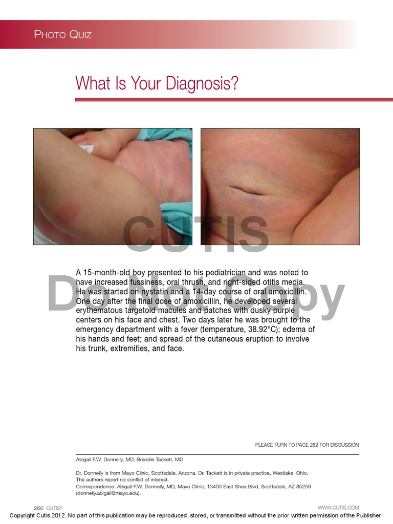 Cutis Do Not Copy: What Is Your Diagnosis? | PDF | Cutaneous Conditions ...