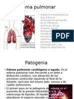 Edema Pulmonar