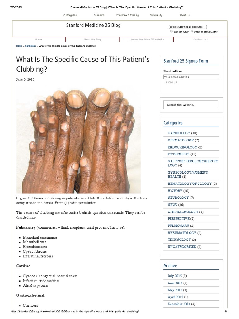 Stanford Medicine 25 Blog - What Is The Specific Cause of This Patient ...