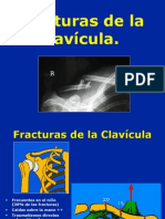 claviculafractura-101018133011-phpapp02